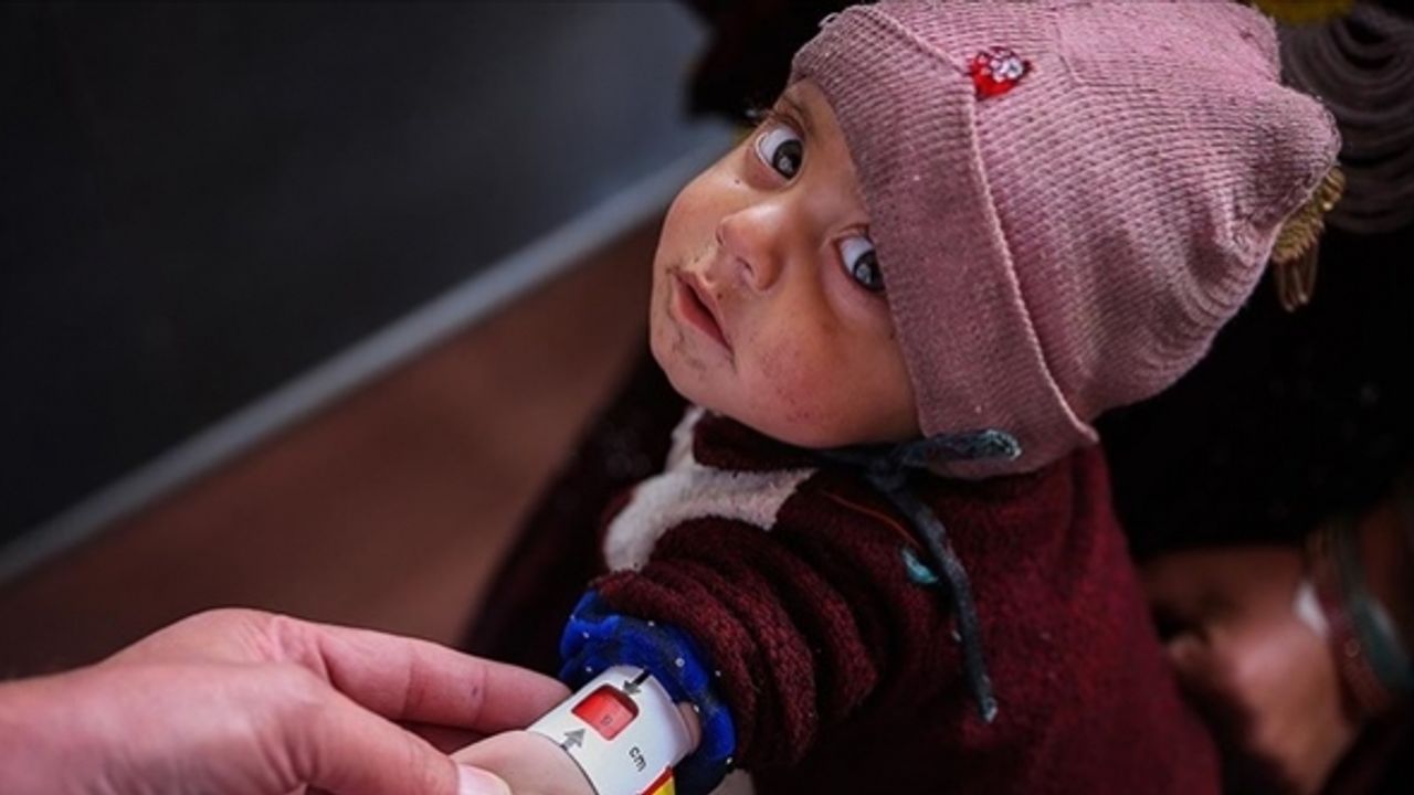 Anneleri sütten kesilen Afgan bebekler büyüyemiyor