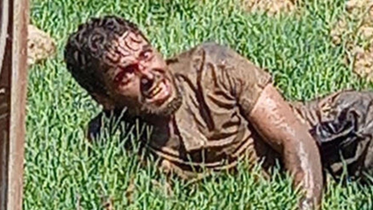 Şanlıurfa'da kuduz olan adam öldü mü? Son durumu nedir? Kötü haber geldi