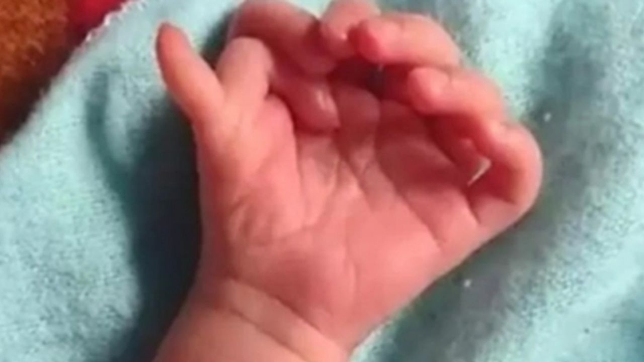 26 parmaklı bebeği tanrıça ilan ettiler
