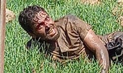 Şanlıurfa'da kuduz olan adam öldü mü? Son durumu nedir? Kötü haber geldi